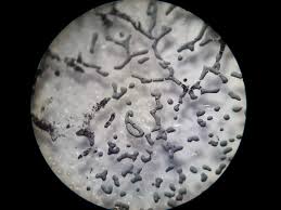 Attēlu rezultāti vaicājumam “Physarum cinereum macro”