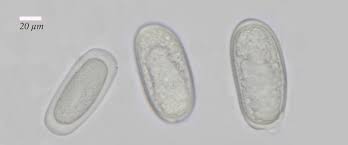 Attēlu rezultāti vaicājumam “Mycoblastus sanguinarius”