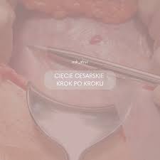 Image result for cesarskie