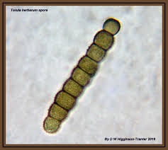 Attēlu rezultāti vaicājumam “Diderma cingulatum spores”