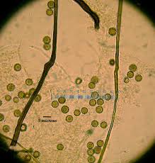Attēlu rezultāti vaicājumam “Reticularia lycoperdon spores”