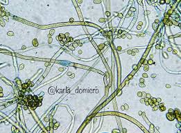 Attēlu rezultāti vaicājumam “Coleosporium sp.”
