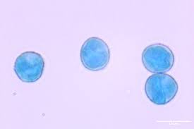Attēlu rezultāti vaicājumam “Clastoderma debaryanum spores”