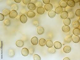 Attēlu rezultāti vaicājumam “myxomicetes”