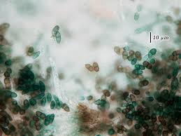 Attēlu rezultāti vaicājumam “Calicium adspersum”