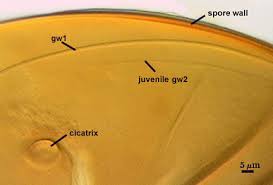 Attēlu rezultāti vaicājumam “Fuligo laevis spores”