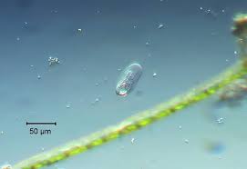 Attēlu rezultāti vaicājumam “Trichia ambigua spores”