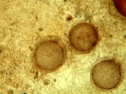 Attēlu rezultāti vaicājumam “Blepharostoma trichophyllum sporophyte”