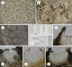 Attēlu rezultāti vaicājumam “Hertelidea botryosa”