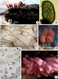 Attēlu rezultāti vaicājumam “Diderma cingulatum spores”