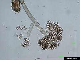Attēlu rezultāti vaicājumam “Trichia botrytis var. cerifera spores”