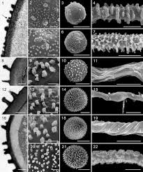 Attēlu rezultāti vaicājumam “Badhamia foliicola sessile”