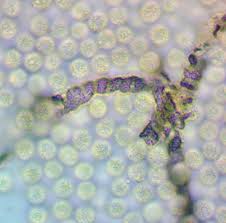 Attēlu rezultāti vaicājumam “Lycogala fuscoolearium macro”