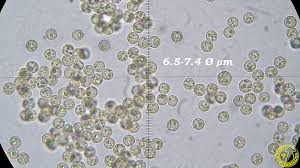 Attēlu rezultāti vaicājumam “Cribraria argillacea spores”