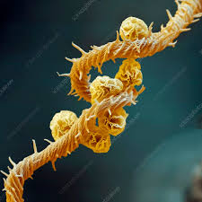 Attēlu rezultāti vaicājumam “Hemitrichia serpula spores”