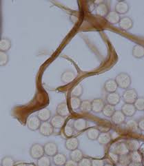 Attēlu rezultāti vaicājumam “Stemonitopsis hyperopta var. landewaldii young”