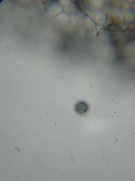 Attēlu rezultāti vaicājumam “Stemonitopsis hyperopta var. landewaldii stalked”