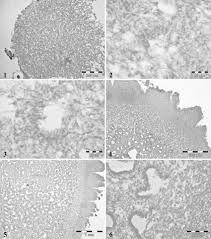 Attēlu rezultāti vaicājumam “Lycoperdon pyriforme young”