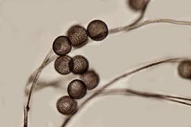 Attēlu rezultāti vaicājumam “Diderma umbilicatum macro”