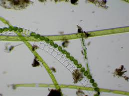 Attēlu rezultāti vaicājumam “Lycogala alisaulianovae macro”