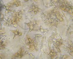 Attēlu rezultāti vaicājumam “Didymium clavus spores”