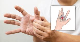 Znalezione obrazy dla zapytania palec