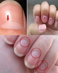 Image result for lunula nail