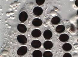 Attēlu rezultāti vaicājumam “Biscogniauxia marginata”