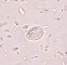 Attēlu rezultāti vaicājumam “Trichia ambigua spores”