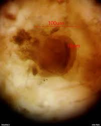 Attēlu rezultāti vaicājumam “Lycogala ustulatum macro”