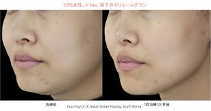 「エレア・サーブラフ」の画像検索結果