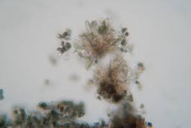 Attēlu rezultāti vaicājumam “Calicium adspersum”