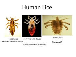 Attēlu rezultāti vaicājumam “Pediculus humanus capitis”