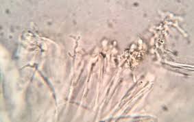 Attēlu rezultāti vaicājumam “Propolis farinosa”