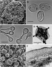 Attēlu rezultāti vaicājumam “Melampsora epitea”