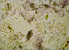 Attēlu rezultāti vaicājumam “Arthonia spadicea”