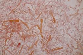 Attēlu rezultāti vaicājumam “Corticium roseum”