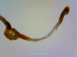 Attēlu rezultāti vaicājumam “Heterotrichia oerstedii (syn. Arcyria oerstedii) stalked”