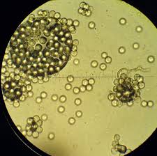 Attēlu rezultāti vaicājumam “Arcyria cinerea macro”