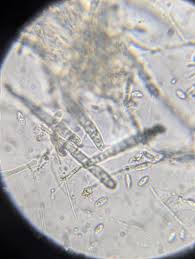 Attēlu rezultāti vaicājumam “Hymenoscyphus sp.”