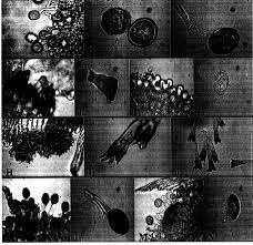 Attēlu rezultāti vaicājumam “Puccinia agrostidis”