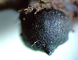 Attēlu rezultāti vaicājumam “Rosellinia desmazieri spores”