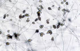 Attēlu rezultāti vaicājumam “Campylopus pyriformis sporophyte”