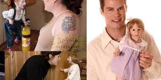 Image result for Nanismo Primordial