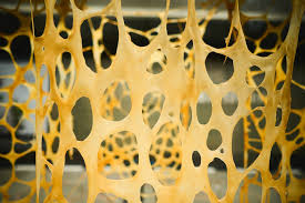 Attēlu rezultāti vaicājumam “Hemitrichia lutescens macro”