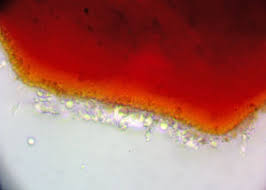 Attēlu rezultāti vaicājumam “Lycogala ustulatum”