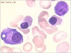 Diz-se haver <b>anemia</b> (do grego,