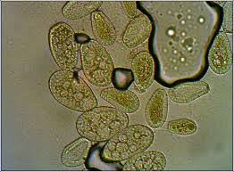 Attēlu rezultāti vaicājumam “Didymium tussilaginis spores”