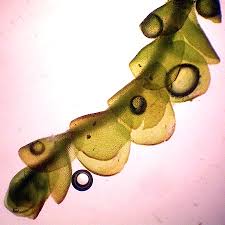 Attēlu rezultāti vaicājumam “Nardia scalaris cells”