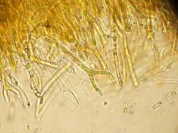 Attēlu rezultāti vaicājumam “Dacrymyces chrysospermus spores”
